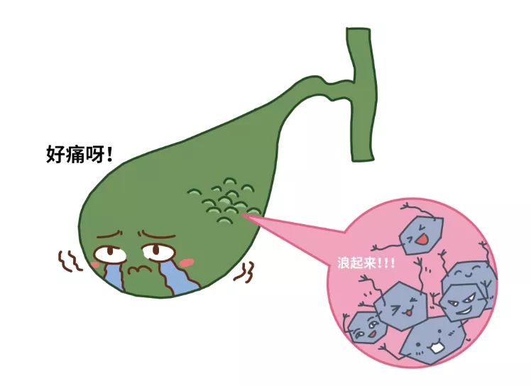 胆囊结石预防有道，动画片的制作来科普如何守护胆囊健康！第3张图片