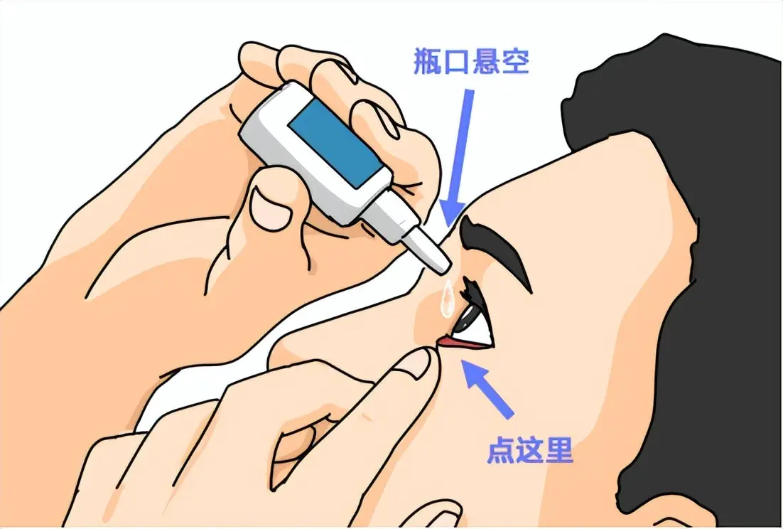 动画设计及制作来推广：你的眼药水使用方式是否正确？