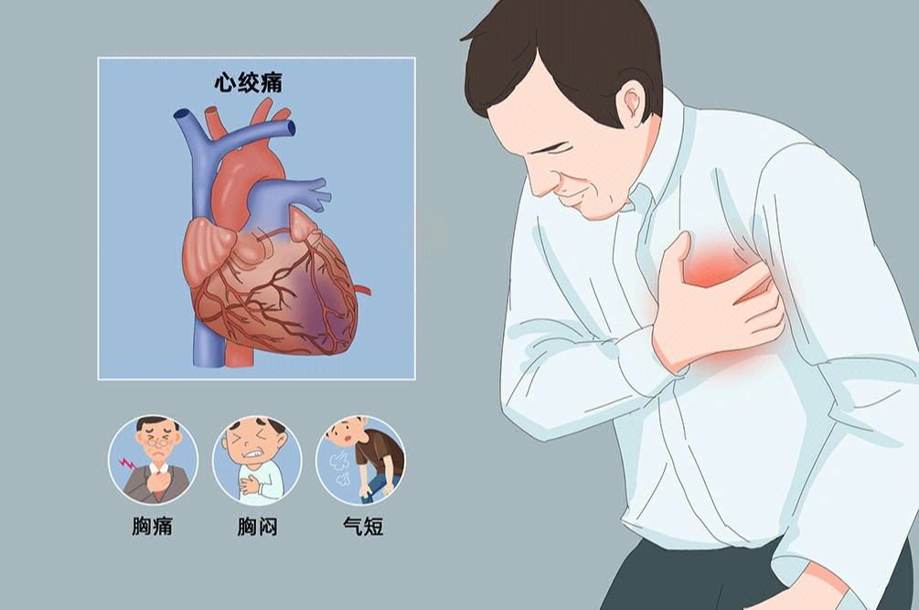 胸痛就一定是心绞痛吗？动画制作直观解读医学知识第2张图片